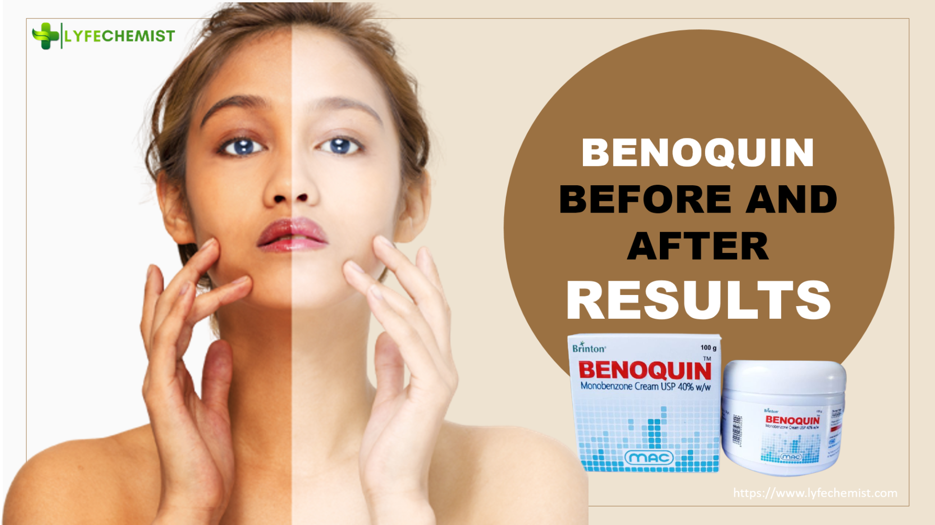 Benoquin before and after results