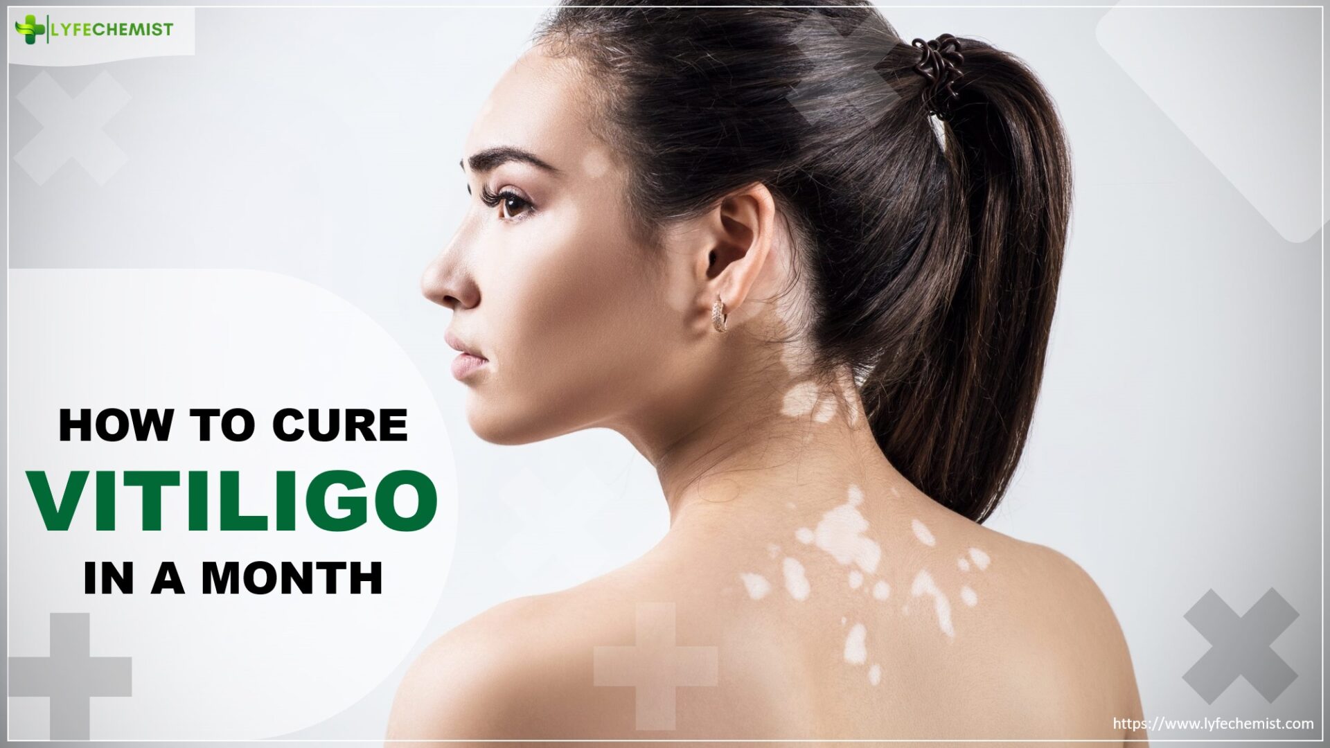 How to cure vitiligo in a month? LyfeChemist
