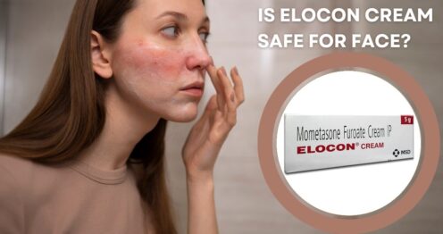 Is Elocon Cream Safe for Face