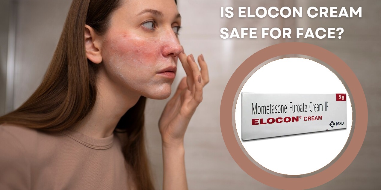 Is Elocon Cream Safe for Face